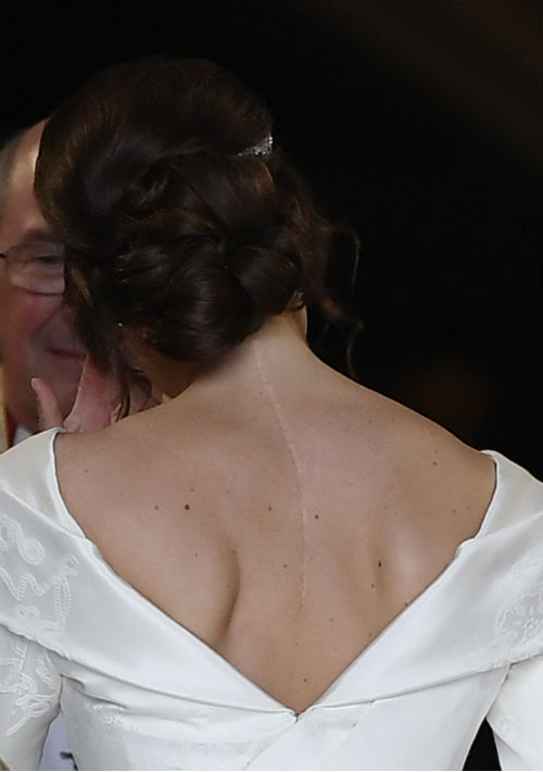 El vestido de Eugenie se cortó en una V profunda en la parte delantera y trasera, una característica solicitada por la novia que reveló una cicatriz vertical de su cirugía a los 12 años para corregir la escoliosis. Ella ha dicho anteriormente que es importante que las personas muestren sus cicatrices. (AP)