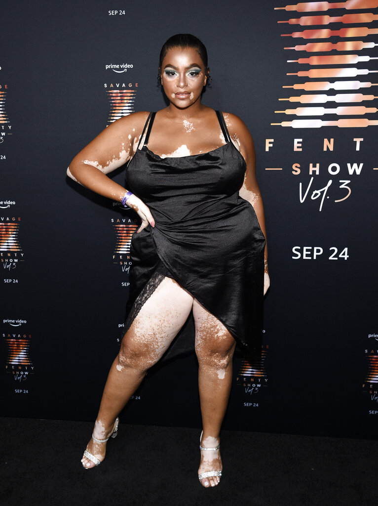 La modelo Janay Watson. (AP)