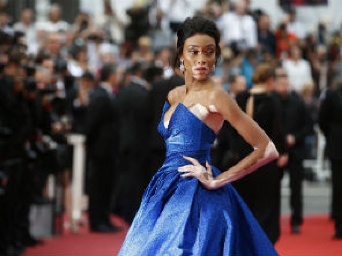 Winnie Harlow pide que dejen de llamarle “la modelo con vitiligo”